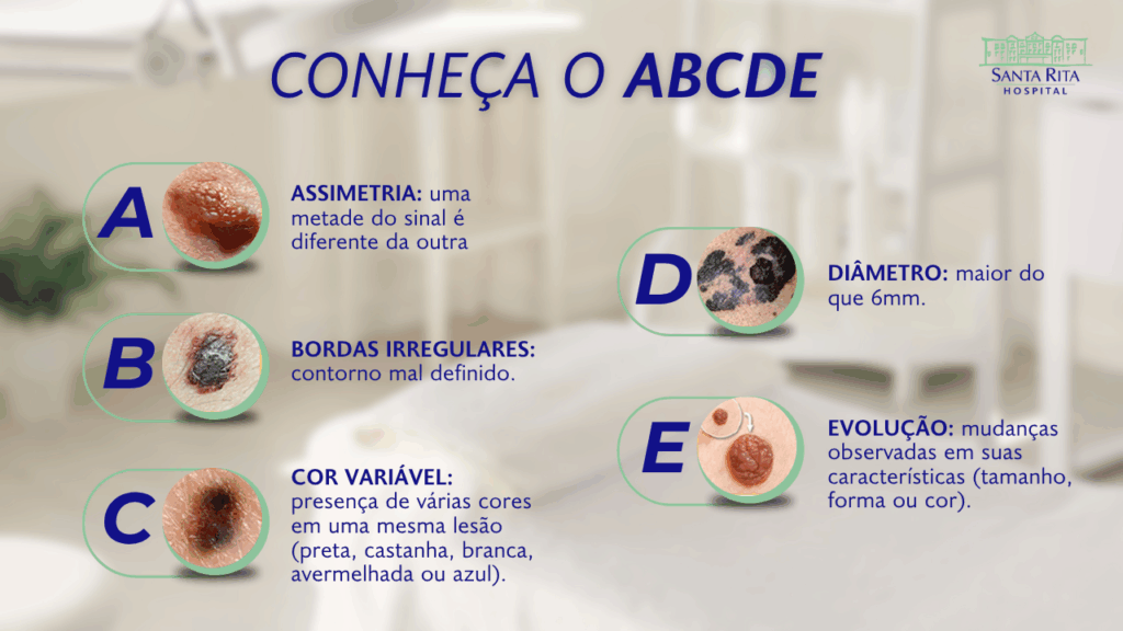 Câncer de pele não melanoma: conscientização e prevenção são essenciais 1 BlogCancerDePele